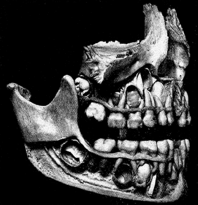 Fig. 1000