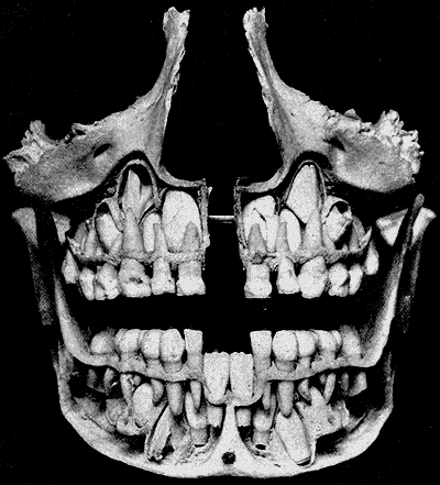 Fig. 1001