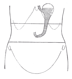 Fig. 1047