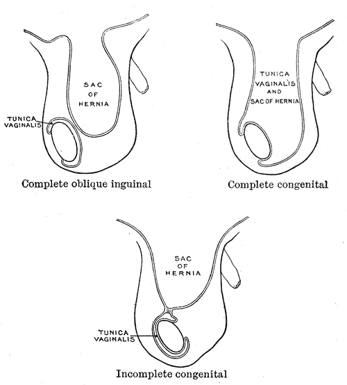 Fig. 1084