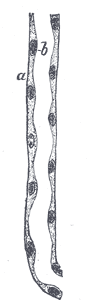 Fig. 1131