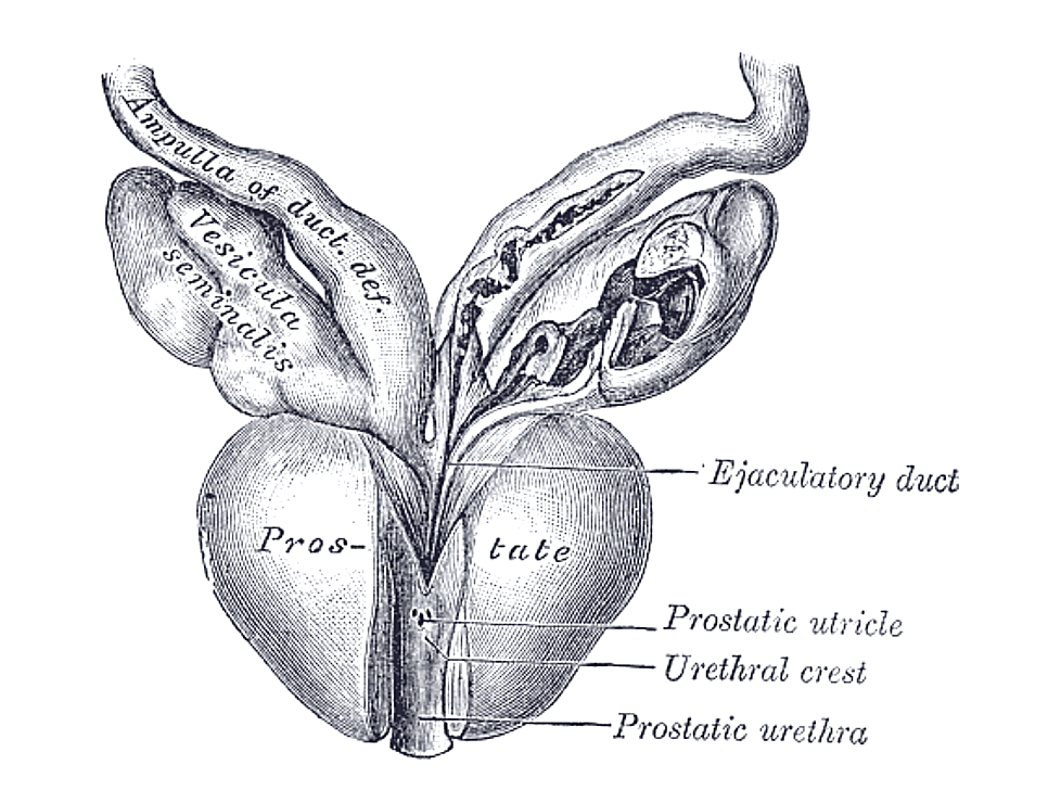 Fig. 1153