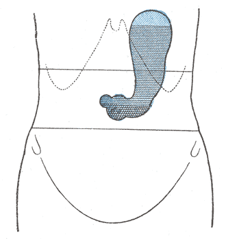 Fig. 1221