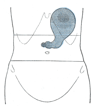 Fig. 1222