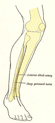 Fig. 1246