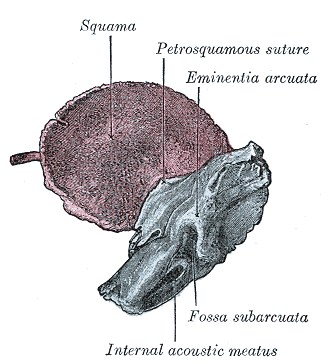 Fig. 144