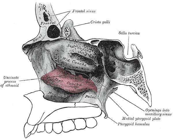 Fig. 170