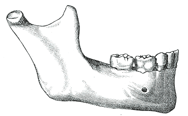 Fig. 183