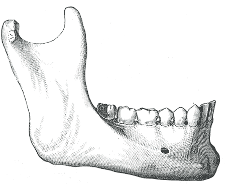 Fig. 184
