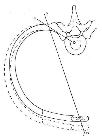 Fig. 317