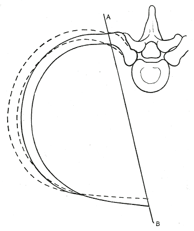 Fig. 318