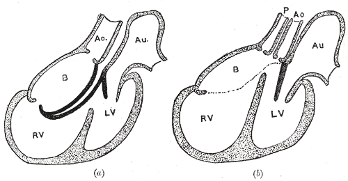 Fig. 469