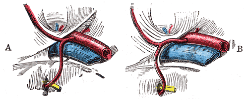 Fig. 541