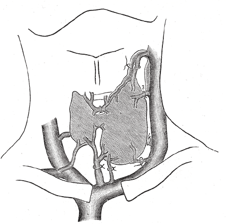 Fig. 561