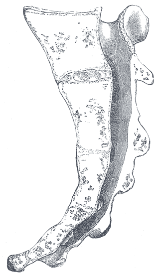 Fig. 99