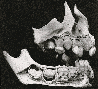 Fig. 998