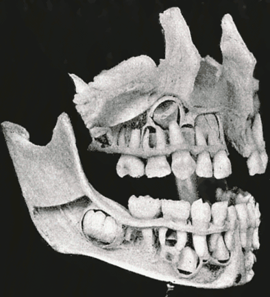 Fig. 999